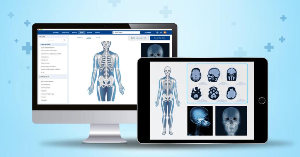 Integrating Orthopedic EMR with Imaging Technologies: Process and Benefits card image